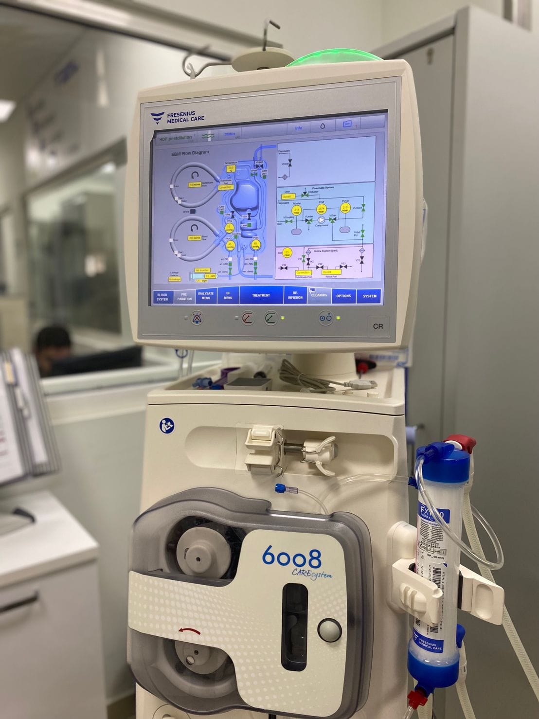 Dialyse: Leven tussen hoop en wanhoop