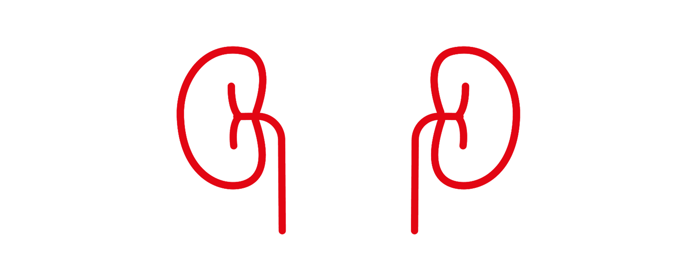 Iwan van de Rijken - Ik zoek een nierdonor (donor gezocht)