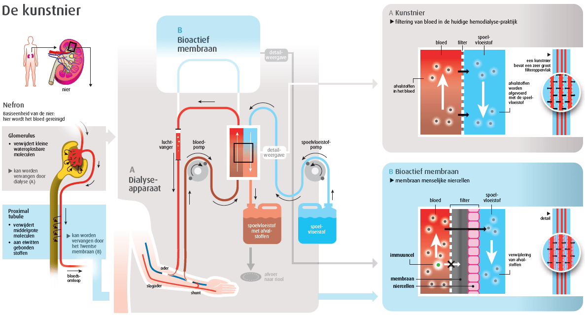 Wat is dialyse en hoe werkt het nu eigenlijk